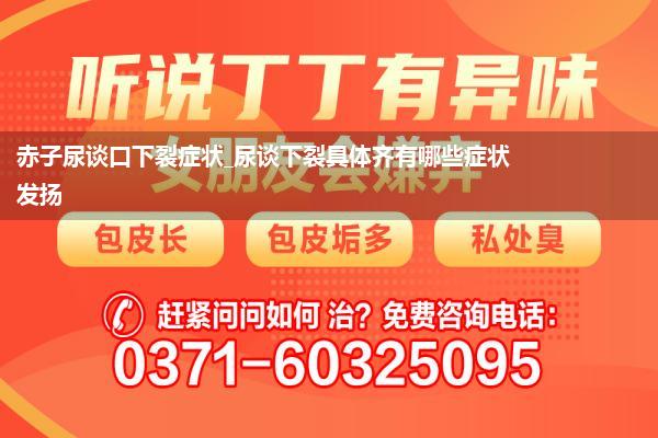 赤子尿谈口下裂症状_尿谈下裂具体齐有哪些症状发扬